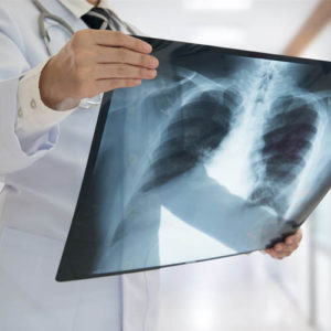TPS Express: Who Shall Decide Your Health Care?